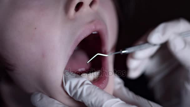 4K primer plano boca del niño examinado por el dentista con herramienta — Vídeos de Stock