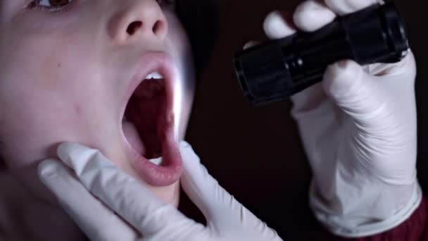 4k Nahaufnahme Kindergesicht vom Arzt im Rachen mit Taschenlampe untersucht — Stockvideo