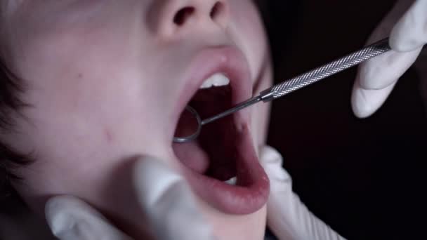 4k Close-up dítě tvář vyšetřen zubaře se zrcadlem