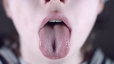 4k yakın dilini doktora gösterilen çocuk kadar