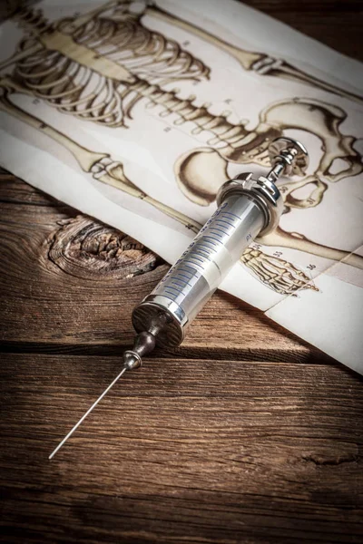 Instruments médicaux anciens . — Photo