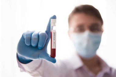 Test tüpü erkek elinde, doktor maskesinde kırmızı sıvıyla bir şişe tutuyor. Kan örneği kavramı, koronavirüs teşhisi, tıbbi araştırma.