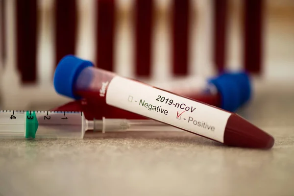 Тестова Трубка Аналізом Крові Тесту Covid Новий Коронавірус 2019 Року — стокове фото