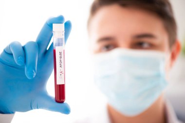 Test tüpü erkek elinde, doktor maske takıp kırmızı sıvıyla şişeyi tutuyor. Kan örneği al, Covid-19 koronavirüs teşhisi.