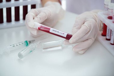 Kan örneği Covid-19 Coronavirus olan test tüpleri. Aşı ve şırınga enjeksiyonu COVID 'den korunma, aşılama ve tedavi için kullanılır.