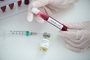Kan örneği Covid-19 Coronavirus olan test tüpleri. Aşı ve şırınga enjeksiyonu COVID 'den korunma, aşılama ve tedavi için kullanılır.