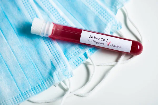 Koronavirus Covid Testovací Zkumavka Krví Identifikovanou Koronavirem Covid Bílém Pozadí — Stock fotografie
