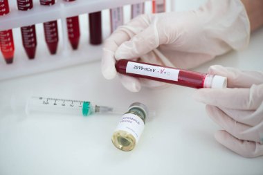 Kan örneği Covid-19 Coronavirus olan test tüpleri. Aşı ve şırınga enjeksiyonu COVID 'den korunma, aşılama ve tedavi için kullanılır.