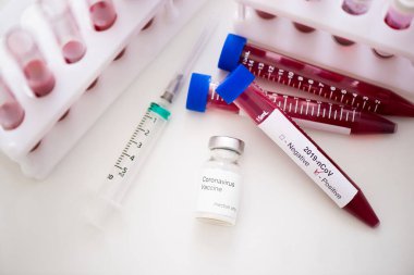 COVID-19 testi için kan örneğiyle test tüpü, yeni Coronavirus 2019. Aşı kavramı, Covid-19 koronavirüs teşhisi, grip virüsünün tedavisi..