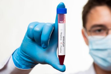Test tüpü erkek elinde, doktor maskesinde kırmızı sıvıyla bir şişe tutuyor. Kan örneği kavramı, koronavirüs teşhisi, tıbbi araştırma.