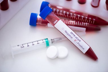COVID-19 testi için kan örneğiyle test tüpü, yeni Coronavirus 2019. Aşı kavramı, Covid-19 koronavirüs teşhisi, grip virüsünün tedavisi..