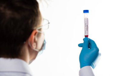 Test tüpü erkek elinde, doktor maskesinde kırmızı sıvıyla bir şişe tutuyor. Kan örneği kavramı, koronavirüs teşhisi, tıbbi araştırma.