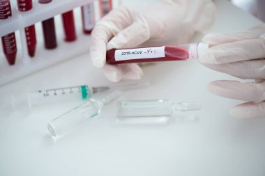 Kan örneği Covid-19 Coronavirus olan test tüpleri. Aşı ve şırınga enjeksiyonu COVID 'den korunma, aşılama ve tedavi için kullanılır.