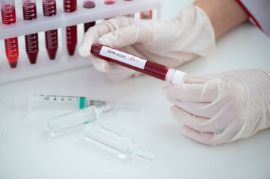 Kan örneği Covid-19 Coronavirus olan test tüpleri. Aşı ve şırınga enjeksiyonu COVID 'den korunma, aşılama ve tedavi için kullanılır.