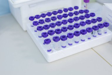 Mavi tıbbi laboratuvar test tüpleri masanın üzerinde.