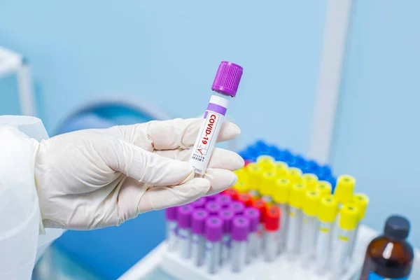 Coronavirus Covid Tubo Exame Sangue Caso Positivo Laboratório Médico — Fotografia de Stock