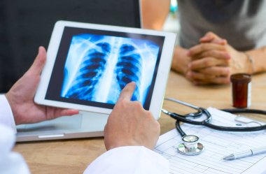 Doktor araçları ve sonuçları x-ray