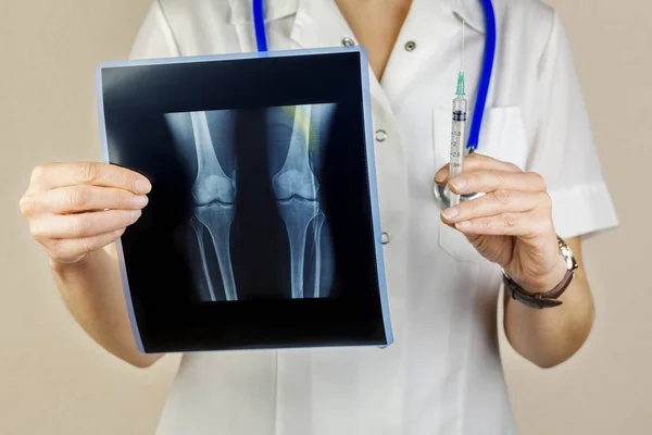 Медсестра с рентгеновским снимком и шприцем — стоковое фото
