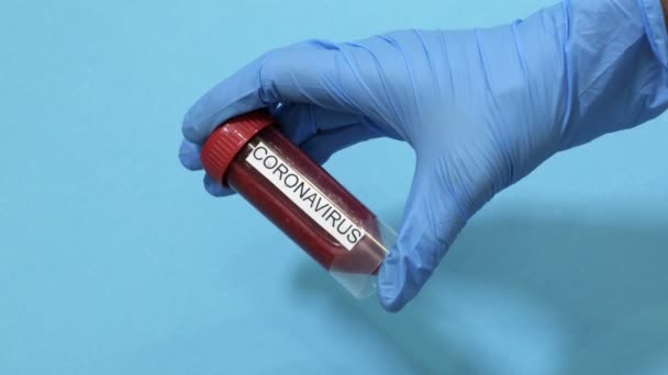 Mano Del Medico Con Campione Sangue Infetto Coronavirus — Video Stock