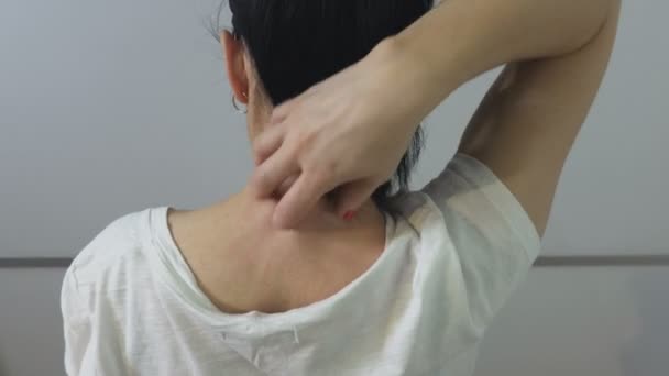 Mujer Arañándose Cuello Con Picazón Con Erupción Alérgica — Vídeos de Stock