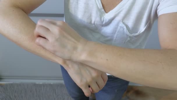 Vrouw Krabt Aan Haar Jeukende Arm Met Allergische Uitslag — Stockvideo