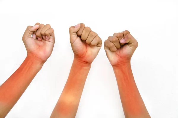 Hand for victory — Stock Photo, Image