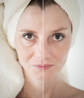 Güzellik kavramı - Cilt Bakımı, Anti aging yordamlar, gençleştirme,