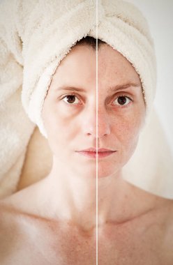 Güzellik kavramı - Cilt Bakımı, Anti aging yordamlar, gençleştirme,
