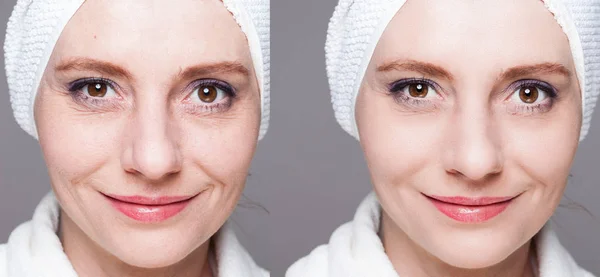 Šťastná žena po kosmetické ošetření před/po záběry - kůže c — Stock fotografie