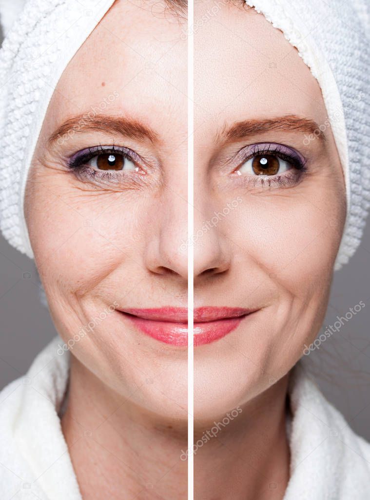 happy woman after beauty treatment - before/after shots - skin c