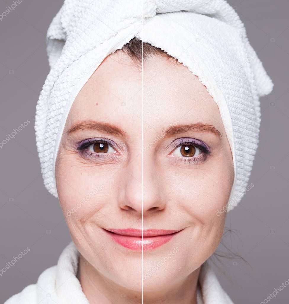 happy woman after beauty treatment - before/after shots - skin c