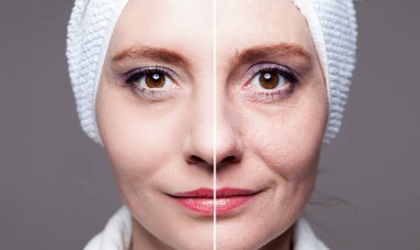 happy woman after beauty treatment - before/after shots - skin c clipart