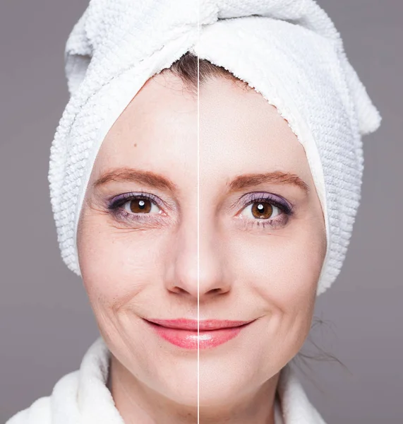 Щаслива жінка після обробки краси - перед/після пострілів - шкіра c — стокове фото