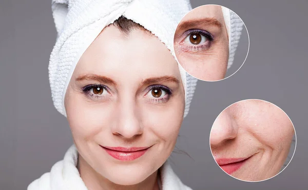 Happy woman after beauty treatment - before/after shots - skin c — Stock Photo, Image