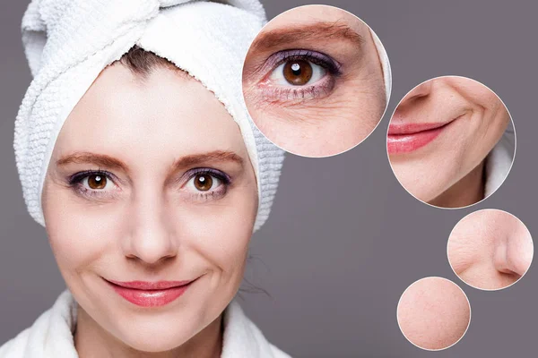 Happy woman after beauty treatment - before/after shots - skin c — Stock Photo, Image