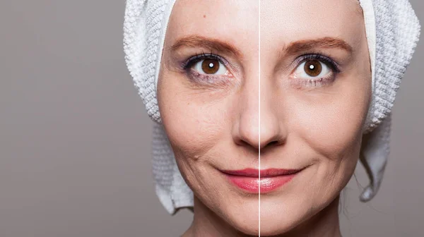 Lycklig kvinna efter skönhet behandling före/efter-bilder - hud c — Stockfoto