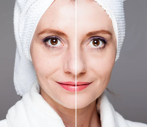 Šťastná žena po kosmetické ošetření před/po záběry - kůže c — Stock fotografie