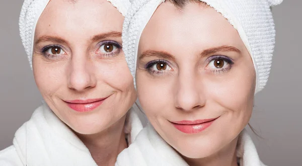 Happy woman after beauty treatment - before/after shots - skin c — Stock Photo, Image