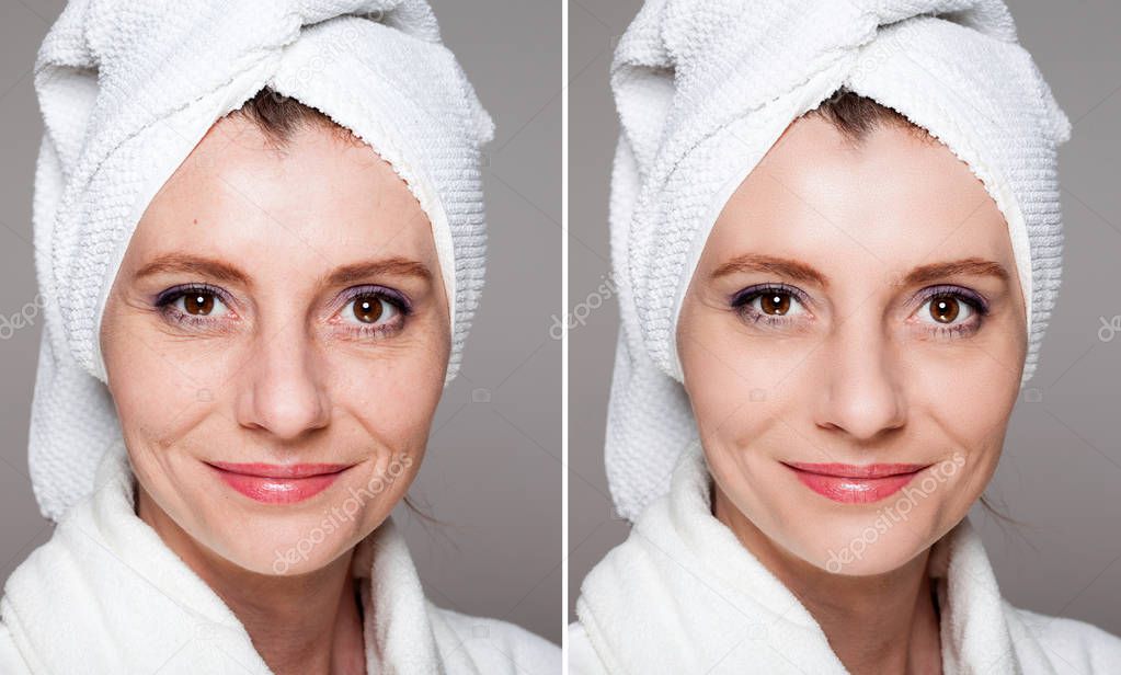 happy woman after beauty treatment - before/after shots - skin c