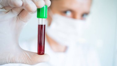 Kadın doktor kan testi Coronavirus 'u tutuyor.