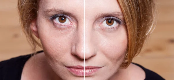 Szczęśliwa Kobieta Zabiegu Upiększającym Przed Ujęciach Pielęgnacja Skóry Zabiegi Aging — Zdjęcie stockowe