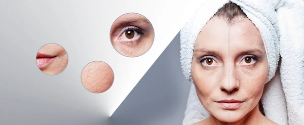 Glückliche Frau Nach Schönheitsbehandlung Vor Nach Aufnahmen Hautpflege Aging Verfahren — Stockfoto