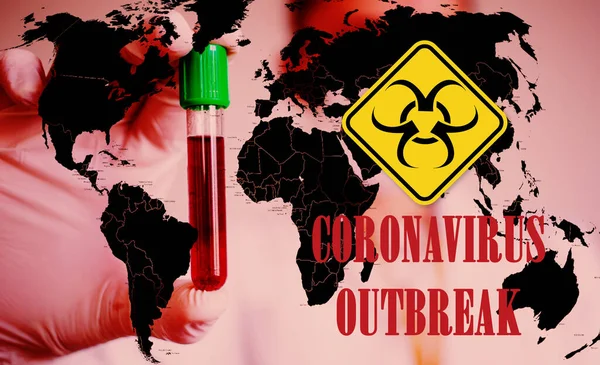 Coronavirus Wereldwijde Strijd Italië Quarantaine Covid Reisverbod Quarantaine — Stockfoto