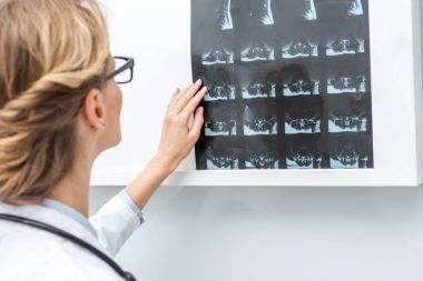 x-ray tarama lambası yapışmasını doktor