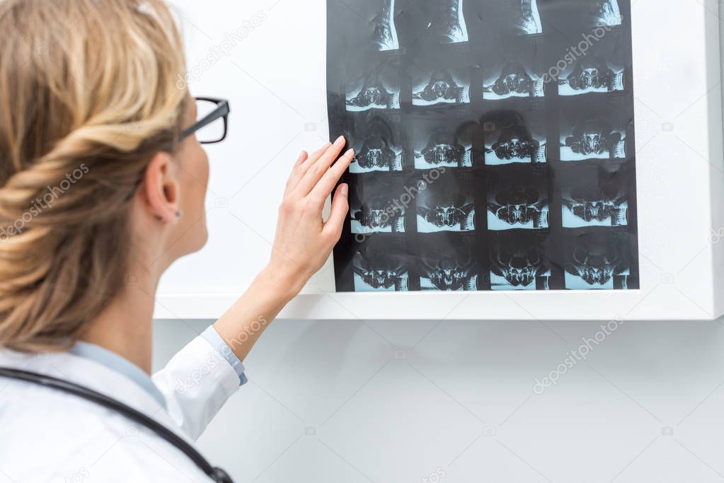 doctor sticking x-ray scan to lamp