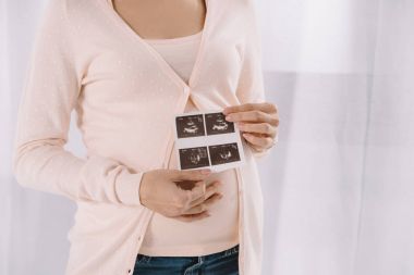cropped image of pregnant woman holding photo of ultrasound diagnostics in hands  clipart