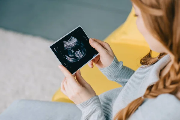 Bijgesneden Afbeelding Van Aantrekkelijke Zwangere Vrouw Kijken Naar Echografie Woonkamer — Stockfoto