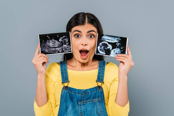 shocked pregnant pretty girl holding fetal ultrasound images isolated on grey