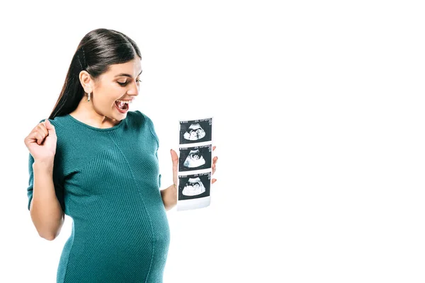 Aufgeregtes Schwangere Mädchen Mit Fetalen Ultraschallbildern Auf Weiß Isoliert — Stockfoto