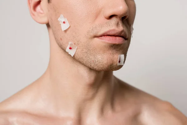 Vista Cortada Homem Com Feridas Sangrentas Após Barba Rosto Isolado — Fotografia de Stock